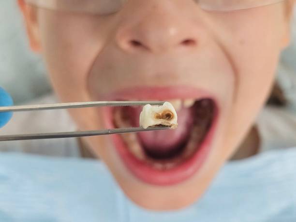 Emergency Gum Pain Relief in NJ